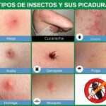 Insectos que causan picaduras y sus efectos